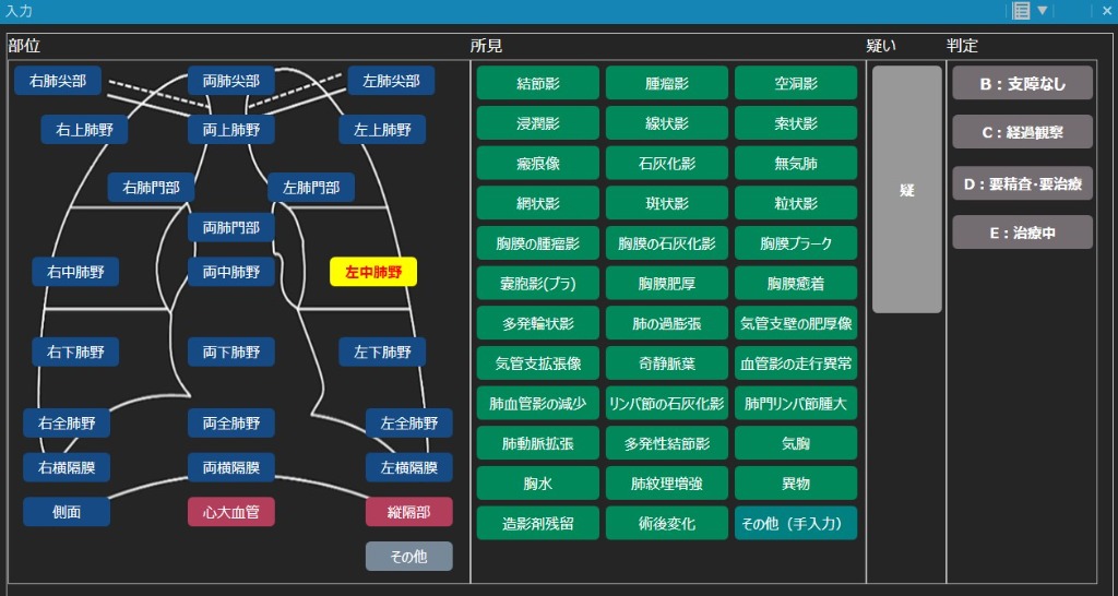 Report Input Interface